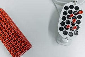 Blood samples undergoing laboratory analysis for advanced cholesterol testing including ApoB and Lipoprotein(a)